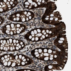 NUDCD3 Antibody, Novus Biologicals:Antibodies:Primary Antibodies