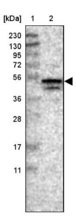 NUDCD3 Antibody, Novus Biologicals 0.1mL; Unlabeled:Antibodies, Polyclonal