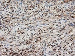 Nudel Antibody (OTI5E11), Novus Biologicals 0.1mL; Unlabeled:Antibodies,
