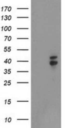 Nudel Antibody (OTI5E11), Novus Biologicals 0.1mL; Unlabeled:Antibodies,