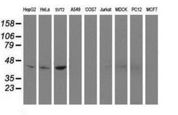 Nudel Antibody (OTI5E11), Novus Biologicals 0.1mL; Unlabeled:Antibodies,