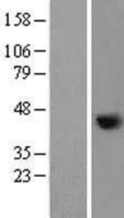 Novus Biologicals&trade;&nbsp;Nudel Overexpression Lysate