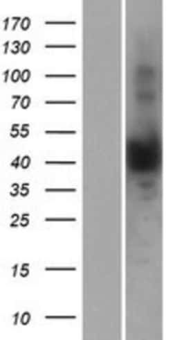 Novus Biologicals&trade;&nbsp;NUDT13 Overexpression Lysate