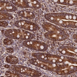 NUDT15 Antibody, Novus Biologicals 0.1mL; Unlabeled:Antibodies, Polyclonal