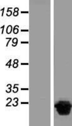 Novus Biologicals&trade;&nbsp;NUDT15 Overexpression Lysate