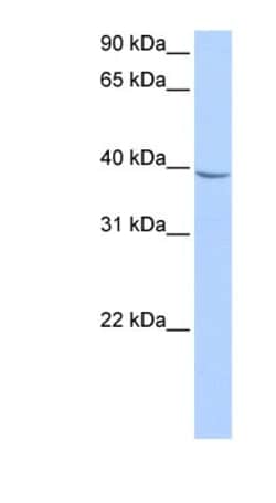 NUDT17 Antibody, Novus Biologicals 20 &mu;L | Buy Online | Novus Biologicals | Fisher Scientific
