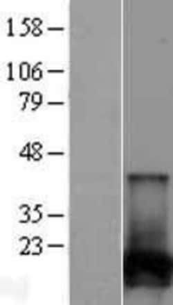 Novus Biologicals&trade;&nbsp;NUDT2 Overexpression Lysate