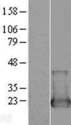 Novus Biologicals™ NUDT2 Overexpression Lysate