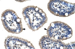 NUDT21 Antibody, Novus Biologicals 0.1mg; Unlabeled:Antibodies, Polyclonal