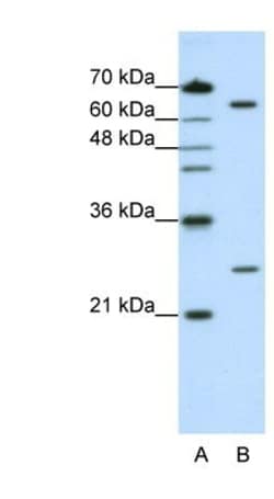NUDT21 Antibody, Novus Biologicals 0.1mg; Unlabeled:Antibodies, Polyclonal