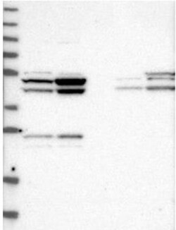 NUDT21 Antibody, Novus Biologicals 25ul | Buy Online | Novus Biologicals | Fisher Scientific