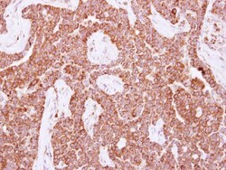 NUDT3 Antibody, Novus Biologicals 0.1mL; Unlabeled:Antibodies, Polyclonal
