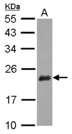 NUDT3 Antibody, Novus Biologicals 0.1mL; Unlabeled:Antibodies, Polyclonal