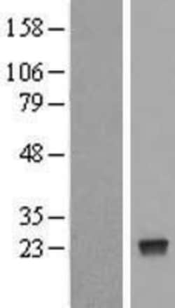 Novus Biologicals&trade;&nbsp;NUDT4 Overexpression Lysate