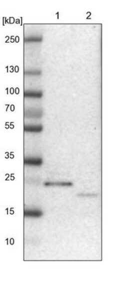 NUDT4 Antibody, Novus Biologicals 0.1mL; Unlabeled:Antibodies, Polyclonal