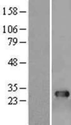 Novus Biologicals™ ADP-Sugar Pyrophosphatase/NUDT5 Overexpression Lysate