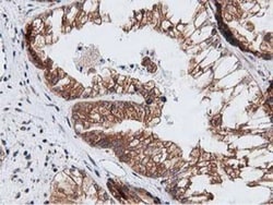 NUDT6 Antibody (OTI9D12), Novus Biologicals 0.1mL; Unlabeled:Antibodies,
