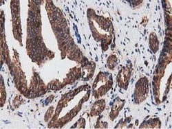 NUDT6 Antibody (OTI9D12), Novus Biologicals 0.1mL; Unlabeled:Antibodies,