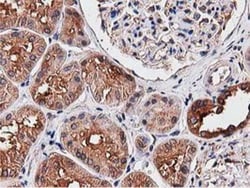 NUDT6 Antibody (OTI9D12), Novus Biologicals 0.1mL; Unlabeled:Antibodies,