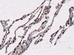 NUDT6 Antibody (OTI9D12), Novus Biologicals 0.1mL; Unlabeled:Antibodies,