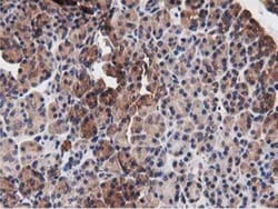 NUDT6 Antibody (OTI9D12), Novus Biologicals 0.1mL; Unlabeled:Antibodies,
