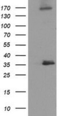 NUDT6 Antibody (OTI9D12), Novus Biologicals 0.1mL; Unlabeled:Antibodies,
