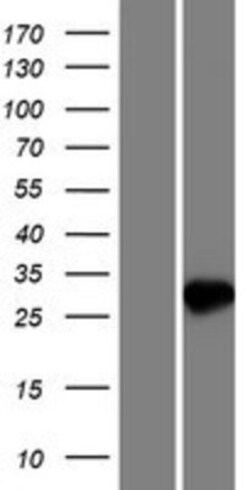 Novus Biologicals&trade;&nbsp;NUDT7 Overexpression Lysate