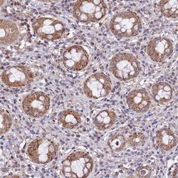 NUDT8 Antibody, Novus Biologicals 25 &mu;L; Unlabeled:Antibodies, Polyclonal