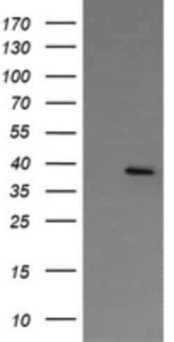 NUDT9 Antibody (OTI 7F12), Novus Biologicals 0.1mL; Unlabeled:Antibodies,