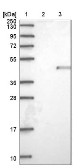 NUDT9 Antibody, Novus Biologicals 25 &mu;L; Unlabeled:Antibodies, Polyclonal