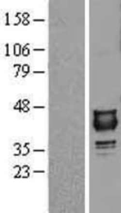 Novus Biologicals&trade;&nbsp;NUDT9 Overexpression Lysate