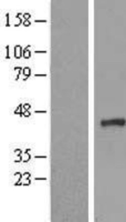 Novus Biologicals™ NUDT9 Overexpression Lysate