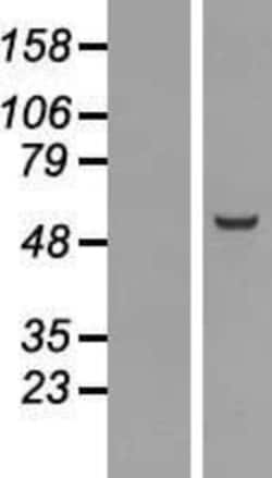 Novus Biologicals&trade;&nbsp;Nuf2 Overexpression Lysate