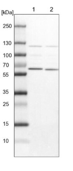 NULP1 Antibody, Novus Biologicals 25 &mu;L, Unconjugated:Antibodies, Polyclonal