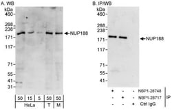 NUP188 Antibody, Novus Biologicals 0.1mg; Unlabeled:Antibodies, Polyclonal