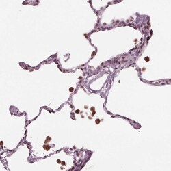 NUP210 Antibody, Novus Biologicals 0.1mL; Unlabeled:Antibodies, Polyclonal