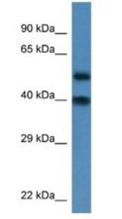 NUP37 Antibody, Novus Biologicals 100μL; Unlabeled:Antibodies, Polyclonal