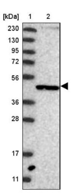 NUP43 Antibody, Novus Biologicals 0.1mL; Unlabeled:Antibodies, Polyclonal