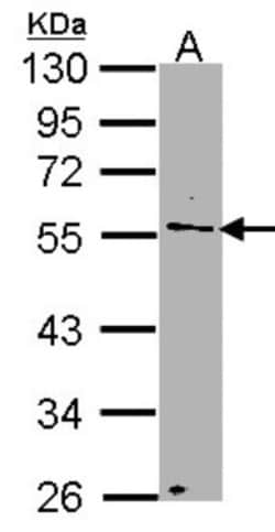 NUP50 Antibody, Novus Biologicals 0.1mL; Unlabeled:Antibodies, Polyclonal