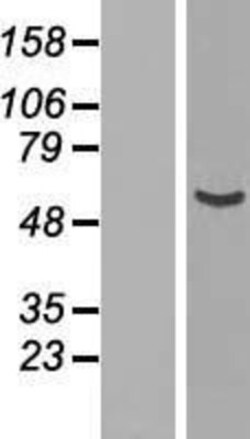 Novus Biologicals™ NUP54 Overexpression Lysate