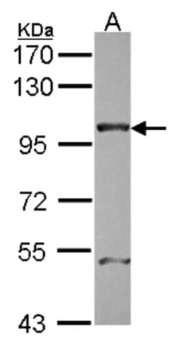 NUP98 Antibody, Novus Biologicals 0.1mL; Unlabeled:Anticuerpos