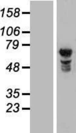 Novus Biologicals™ NUPL1 Overexpression Lysate