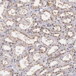 Nurr1/NGFI-B beta/NR4A2 Antibody, Novus Biologicals 0.1mL; Unlabeled:Antibodies,