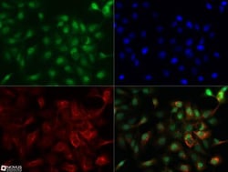 NUT Antibody, Novus Biologicals 0.1mg; Unlabeled:Antibodies, Polyclonal