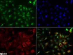 NUT Antibody, Novus Biologicals 0.025mg; Unlabeled:Antibodies, Polyclonal