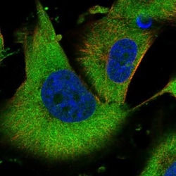 NVL Antibody, Novus Biologicals 0.1mL; Unlabeled:Antibodies, Polyclonal