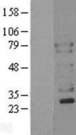 Novus Biologicals&trade;&nbsp;N-WASP Overexpression Lysate