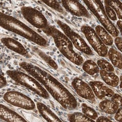 N-WASP Antibody, Novus Biologicals 0.1mL; Unlabeled:Antibodies, Polyclonal