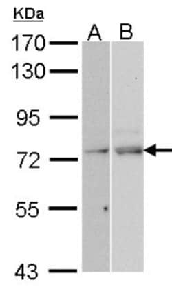 NXF1 Antibody, Novus Biologicals 0.1 mL | Buy Online | Novus Biologicals | Fisher Scientific
