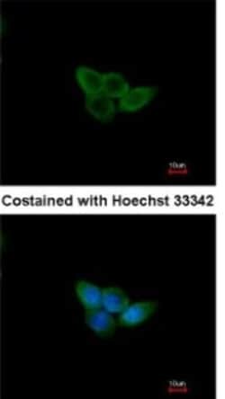 NXF2 Antibody, Novus Biologicals 0.1mL; Unlabeled:Antibodies, Polyclonal